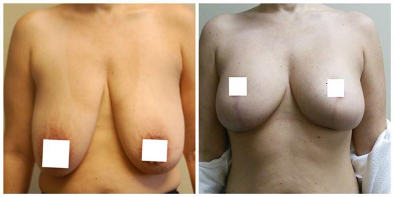 Aesthetic Surgery Institute provider photo