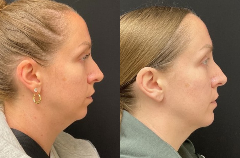A result from Your Cosmetic Office
