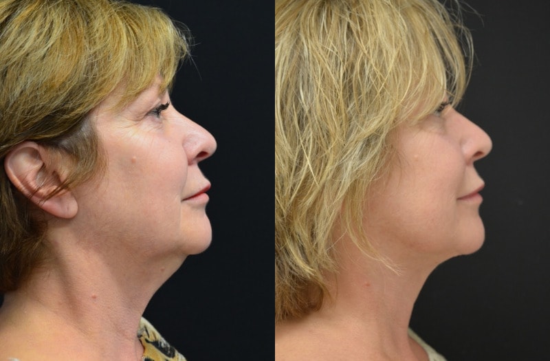 A result from Your Cosmetic Office