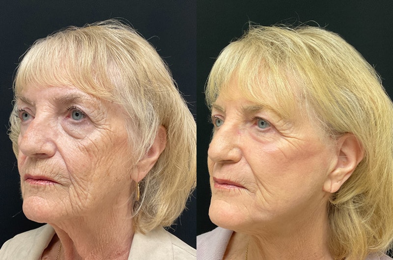 A result from Your Cosmetic Office