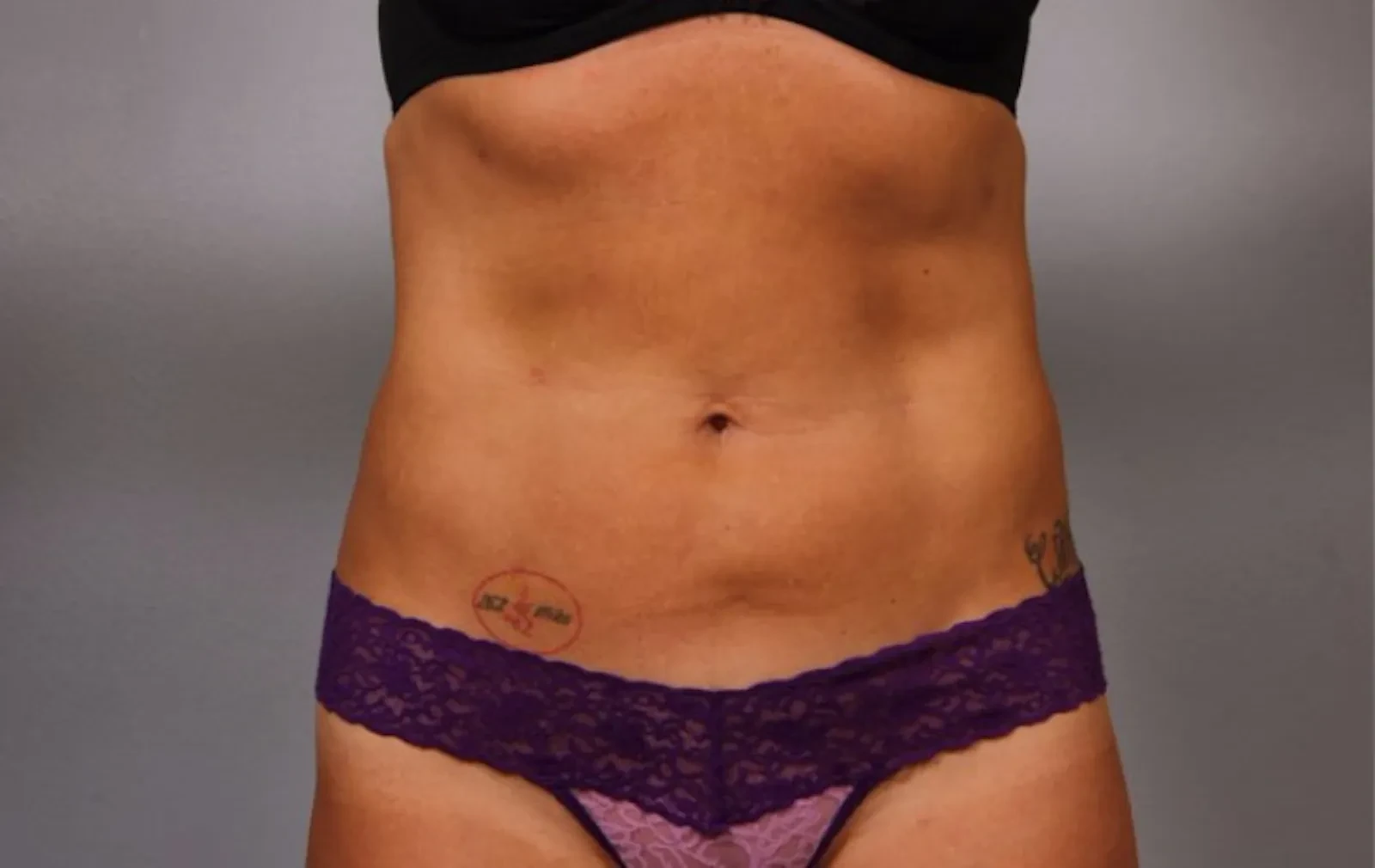 A result from Dr. Diane Duncan