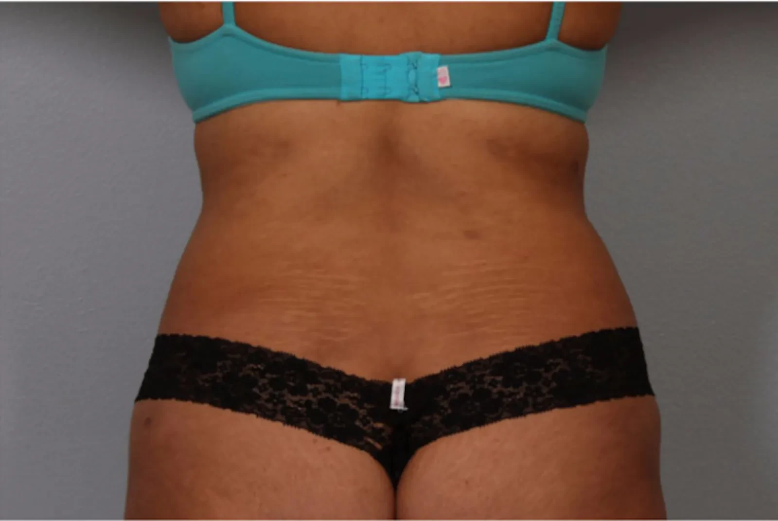 A result from Dr. Diane Duncan