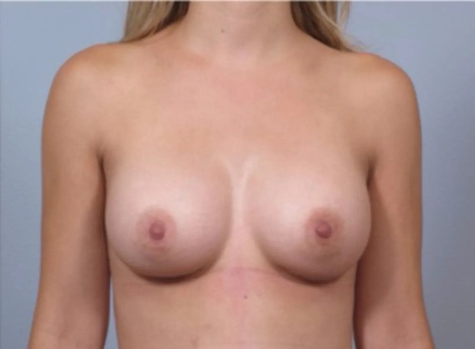 A result from Dr. Diane Duncan