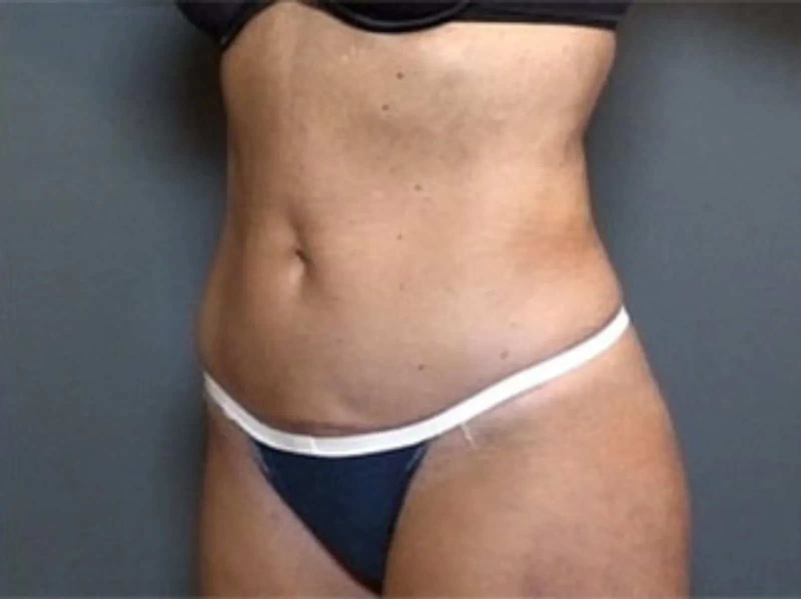 A result from Dr. Diane Duncan