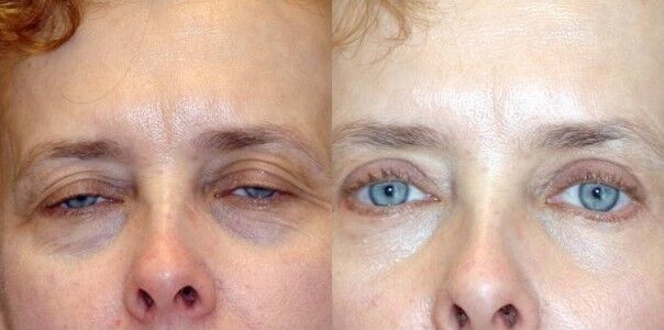 Winslow Facial Plastic Surgery: Catherine Winslow MD provider photo