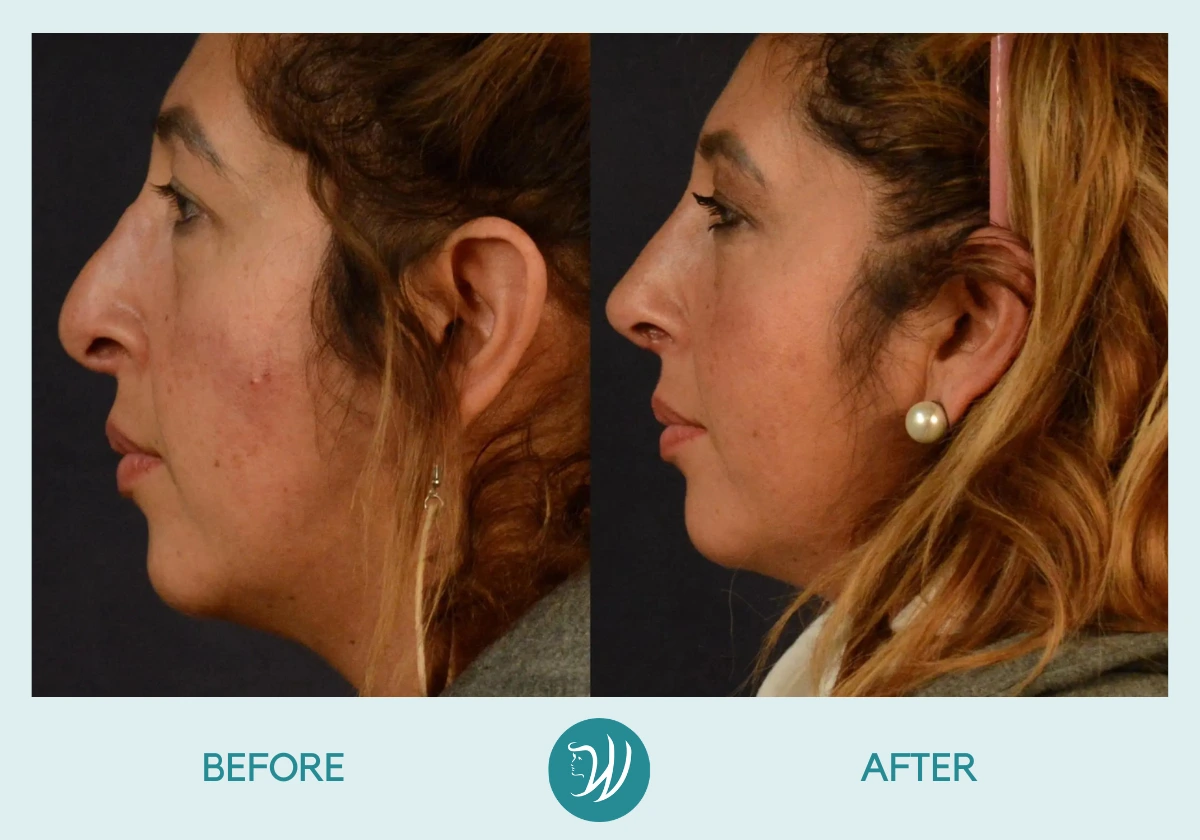 Winslow Facial Plastic Surgery: Catherine Winslow MD provider photo