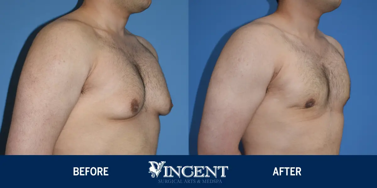A result from Vincent Surgical Arts