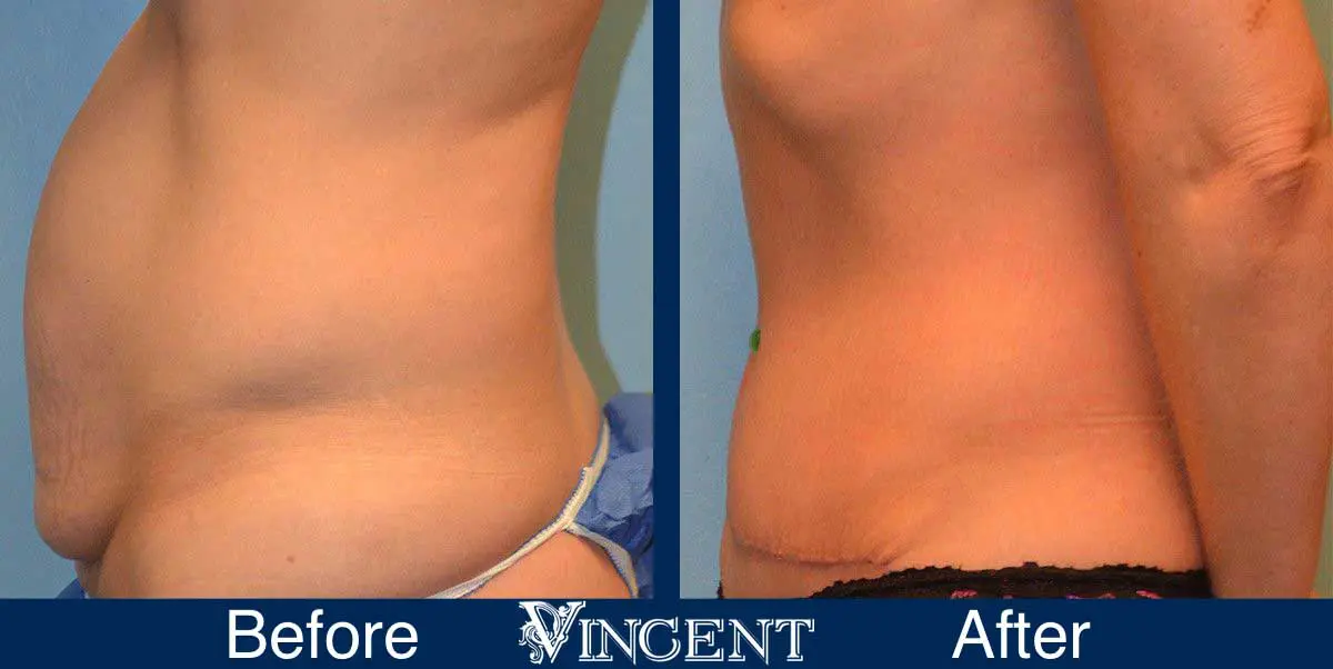 A result from Vincent Surgical Arts