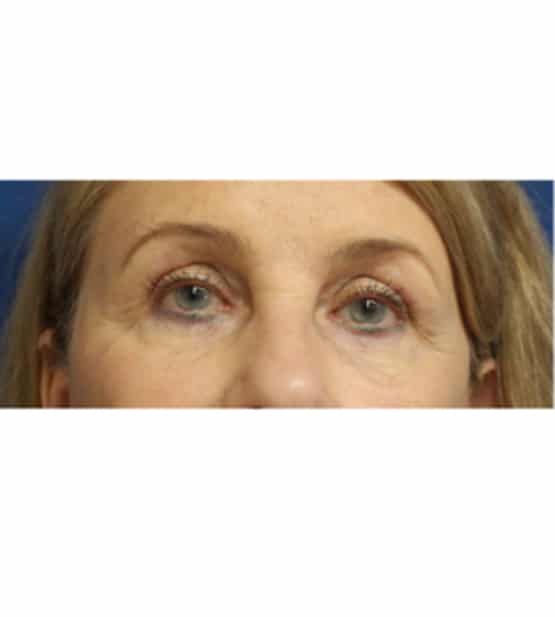 Moy, Fincher, Chipps Facial Plastics & Dermatology - Beverly Hills provider photo
