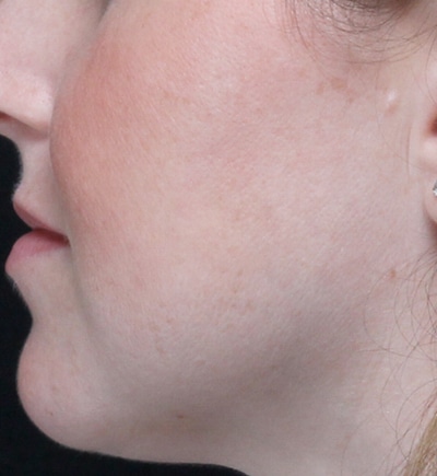Moy, Fincher, Chipps Facial Plastics & Dermatology - Beverly Hills provider photo