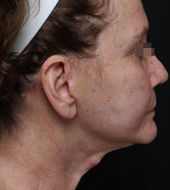 A result from Moy, Fincher, Chipps Facial Plastics & Dermatology - Beverly Hills