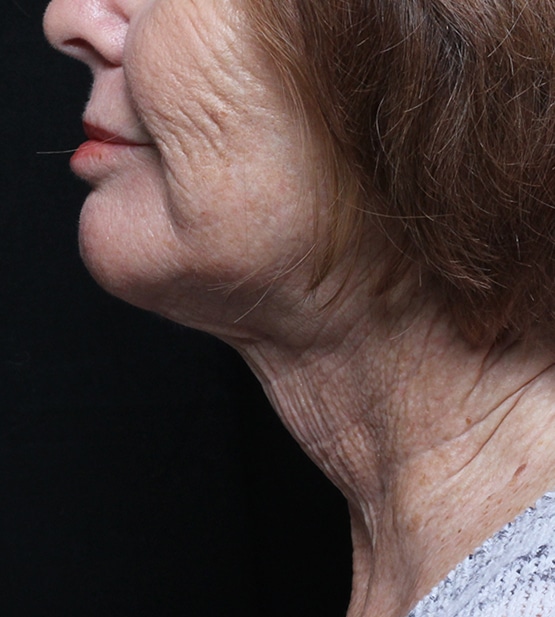 Moy, Fincher, Chipps Facial Plastics & Dermatology - Beverly Hills provider photo