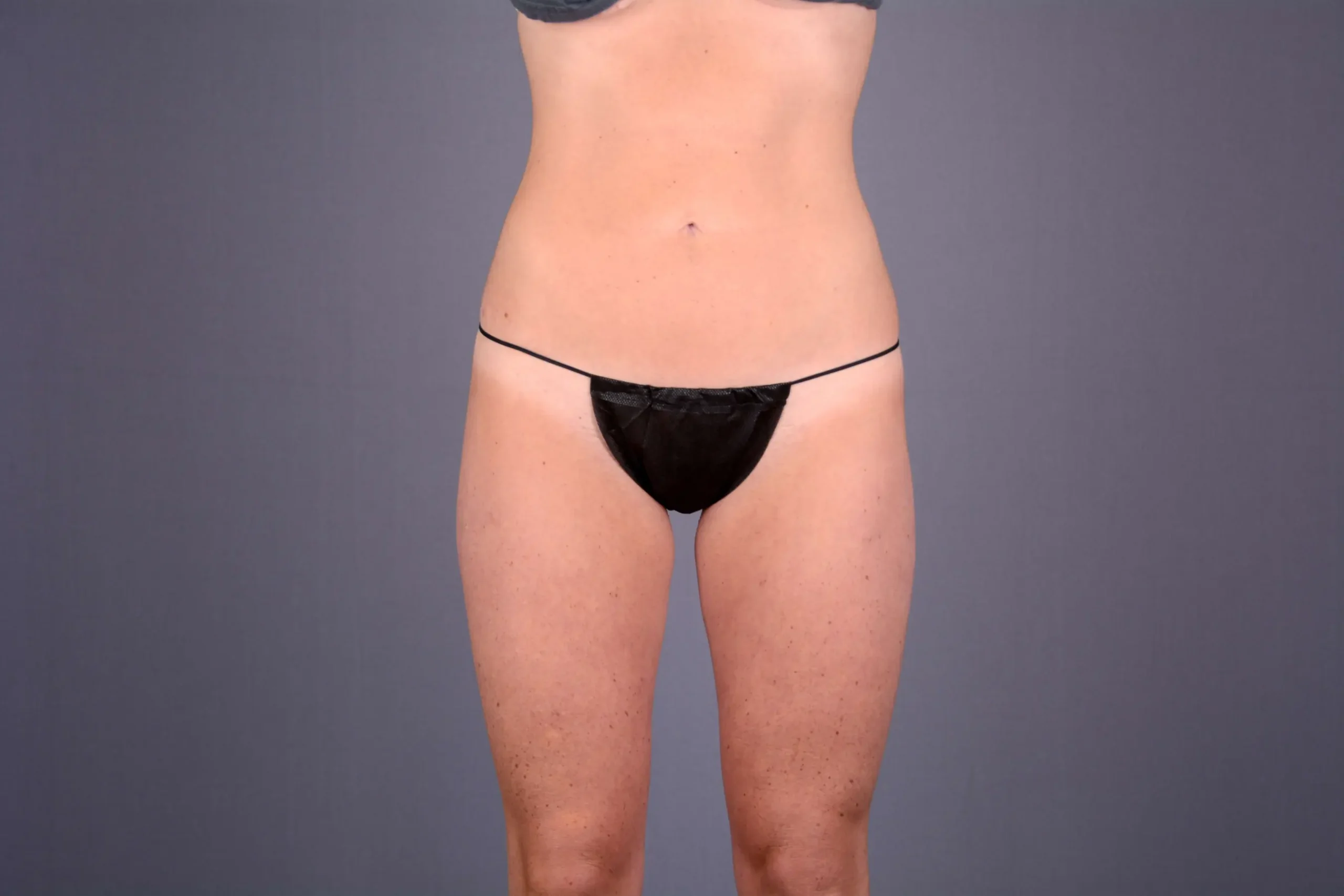 Couture Dermatology & Plastic Surgery after — Las Vegas, NV
