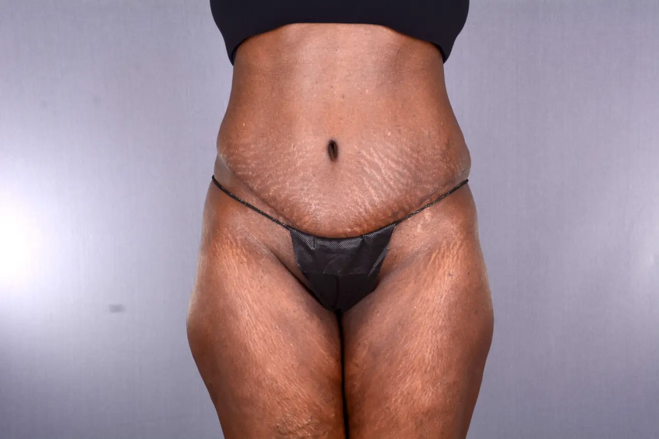 Couture Dermatology & Plastic Surgery after — Las Vegas, NV