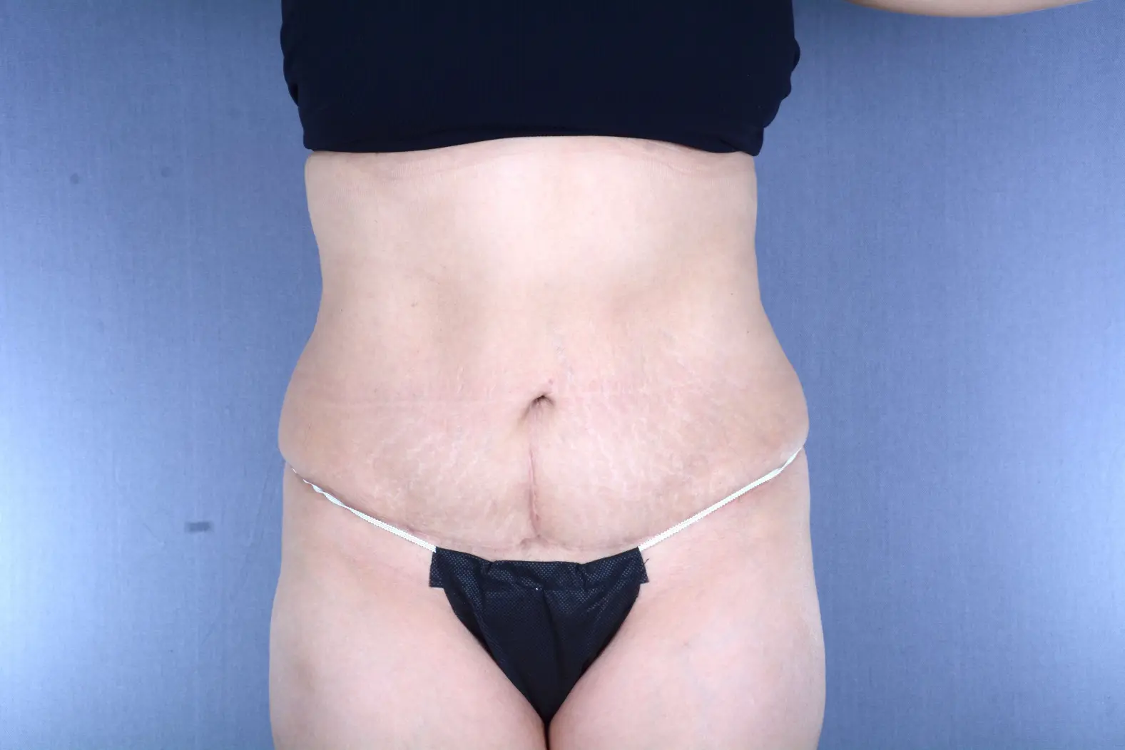 Couture Dermatology & Plastic Surgery after — Las Vegas, NV