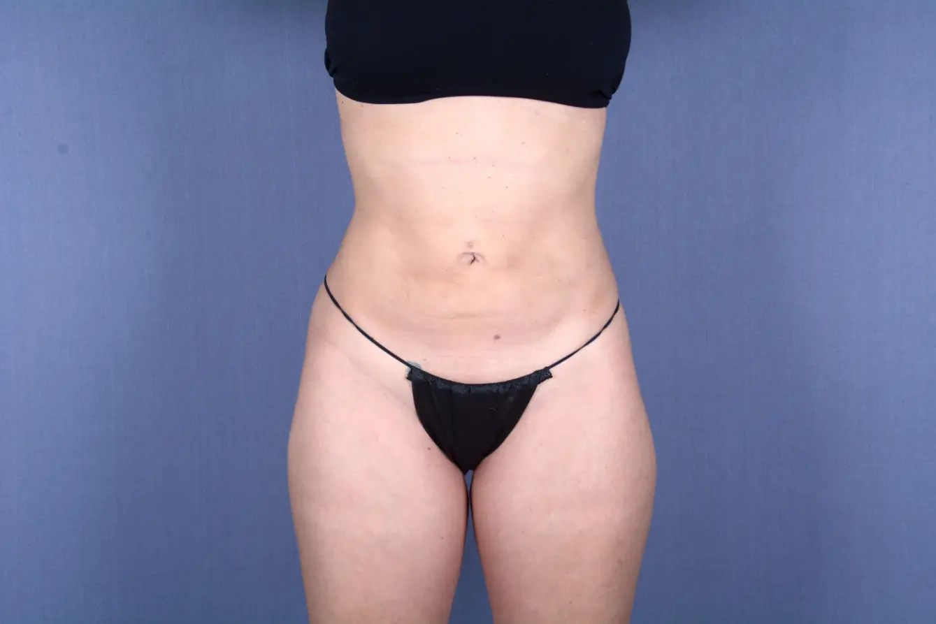 Couture Dermatology & Plastic Surgery after — Las Vegas, NV