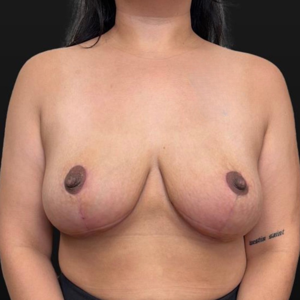 A result from Aesthetic Surgery Centre and Medical Spa