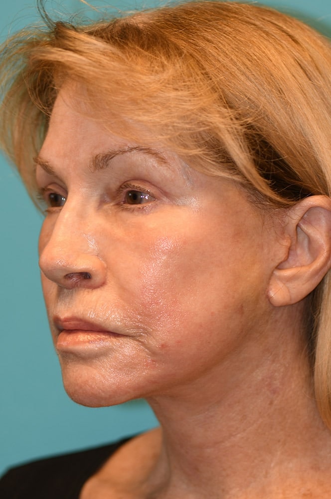 A result from David A. Hecht, MD, PC