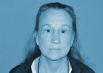 A result from The Clinic of Facial Plastic Surgery