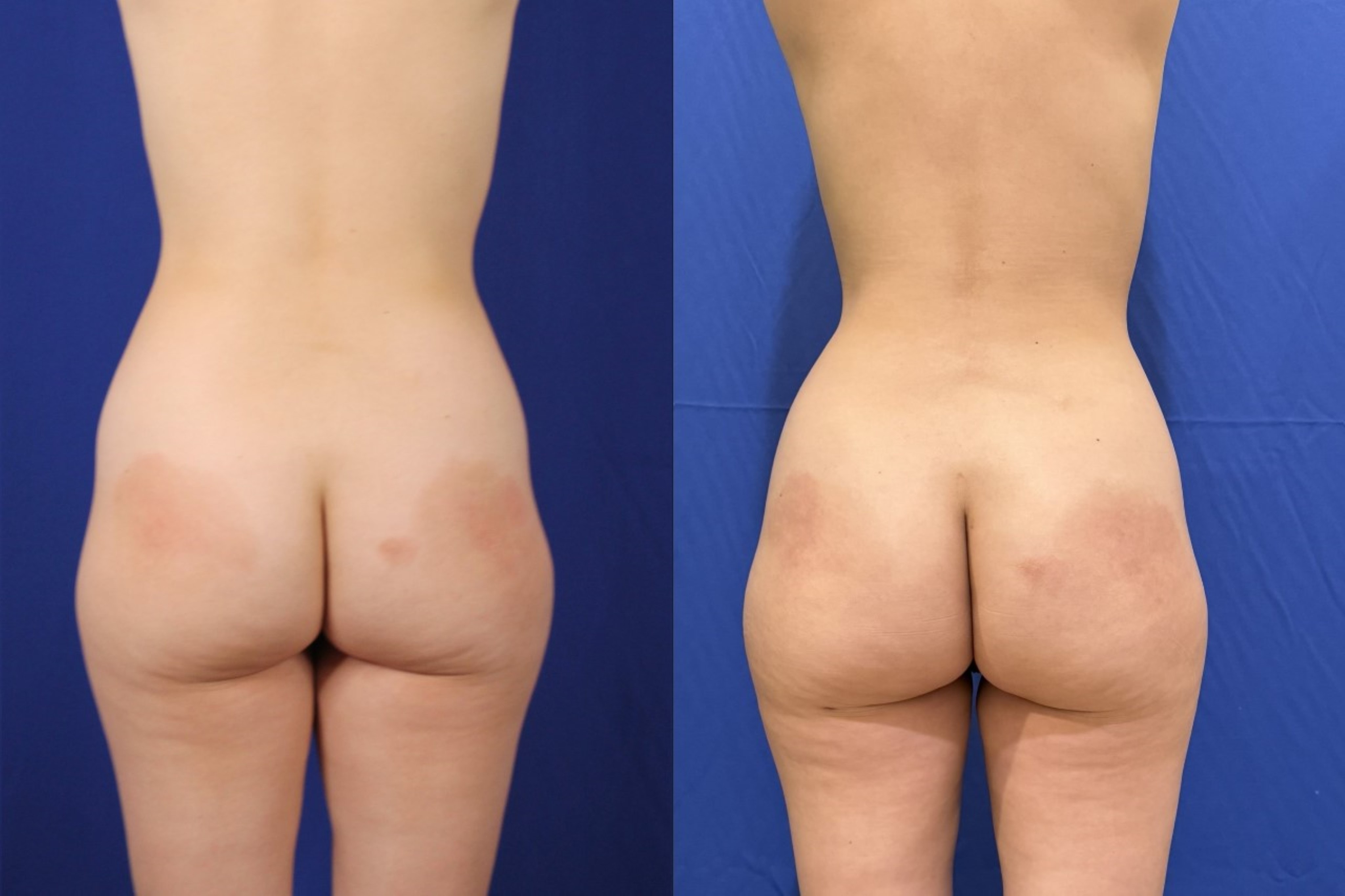 A result from Troell Cosmetic Surgery & Facial Plastic Clinic