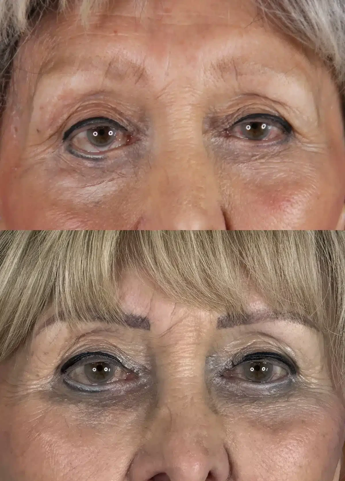 A result from Troell Cosmetic Surgery & Facial Plastic Clinic