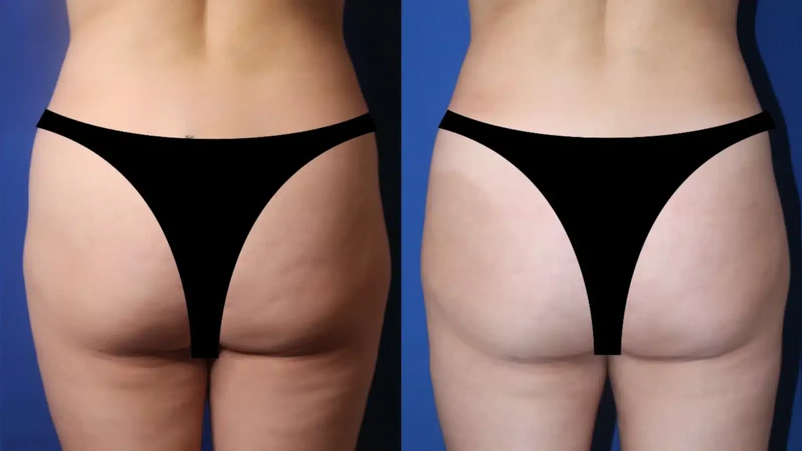 A result from Troell Cosmetic Surgery & Facial Plastic Clinic