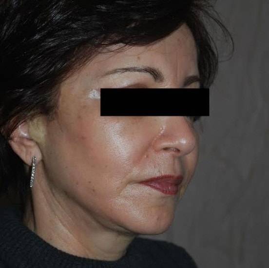 A result from Dr. Roman Rayham, MD