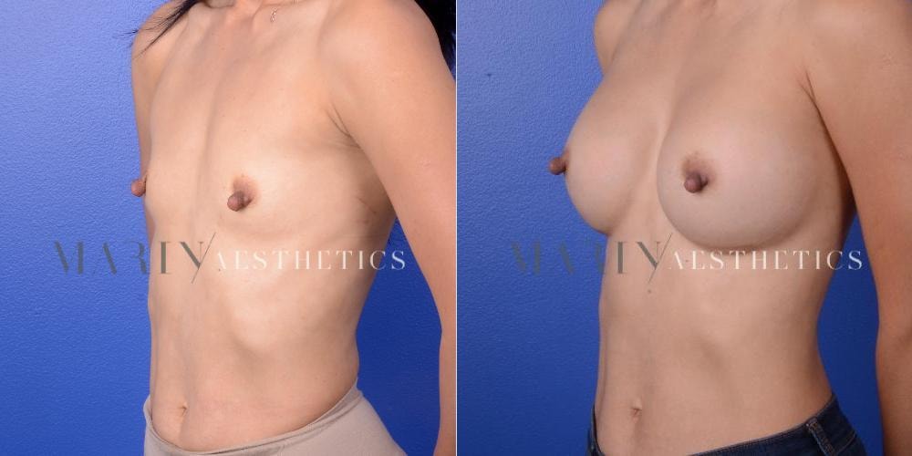A result from Marin Aesthetics