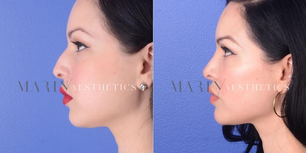 A result from Marin Aesthetics