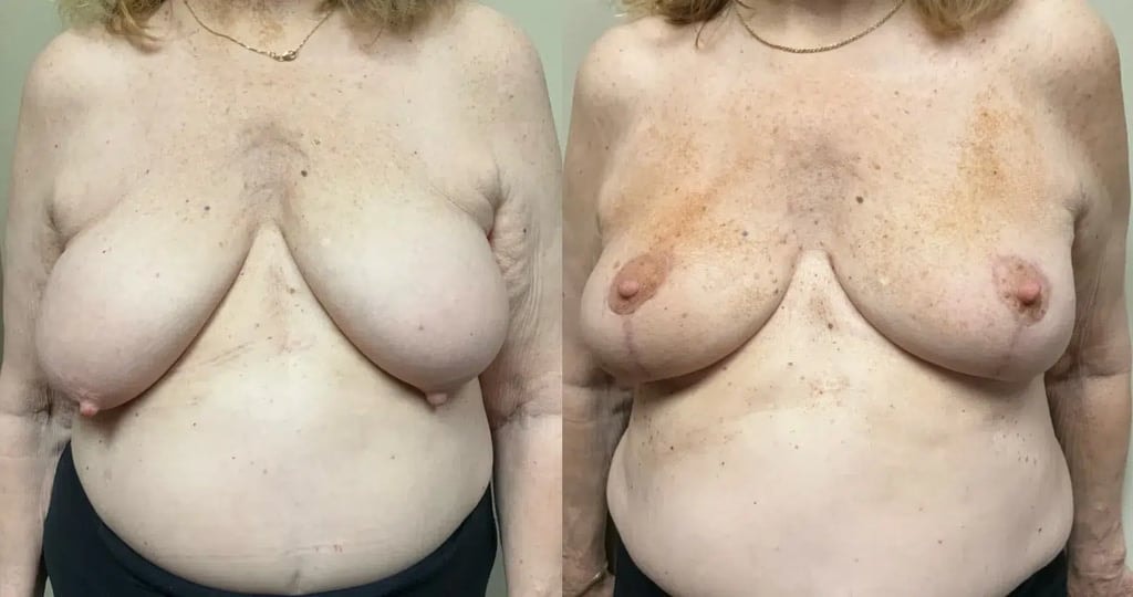 A result from Remington Plastic Surgery