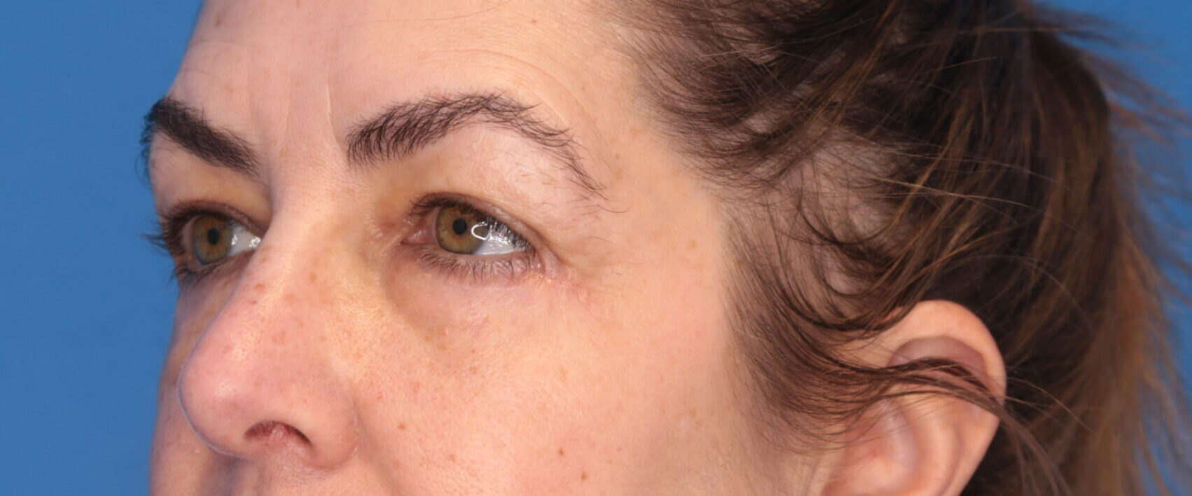 Montante Plastic Surgery & Aesthetics provider photo
