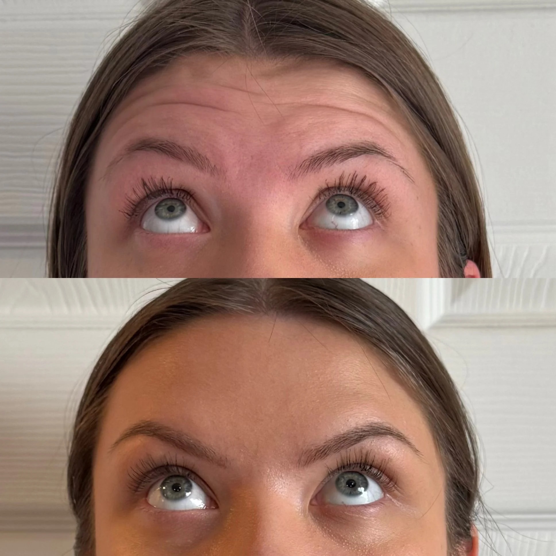 A result from Uniquely You Aesthetics and Wellness