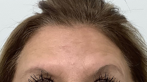 Skinzone Laser & Cosmetic Surgery: Dr. Hannah Vu, MD provider photo
