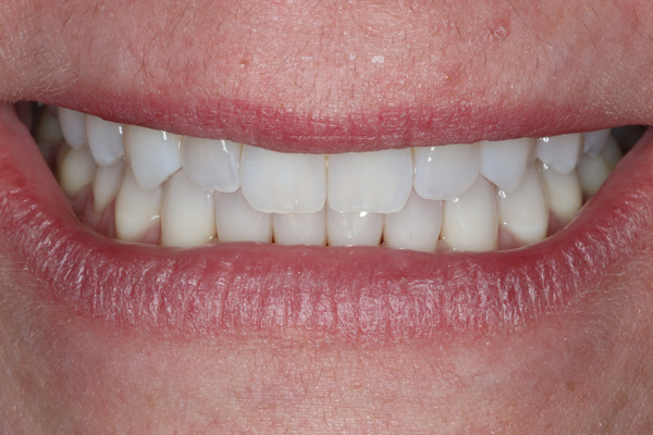 A result from Pearls of Dentistry