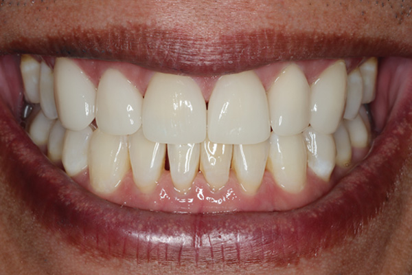 A result from Pearls of Dentistry