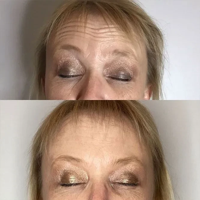 A result from ReJuvU Beauty Haven