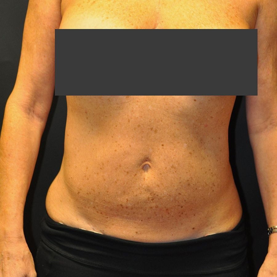A result from Andrew Smith, MD, FACS