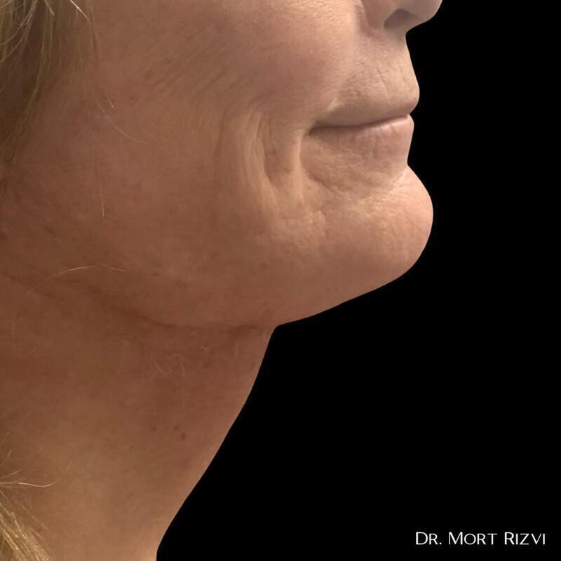 A result from West Empire Plastic Surgery