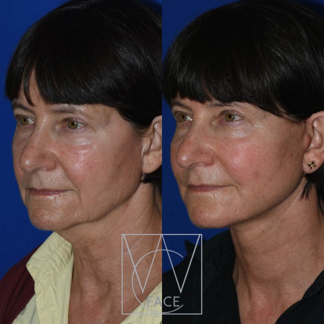 A result from Joseph Shvidler, MD