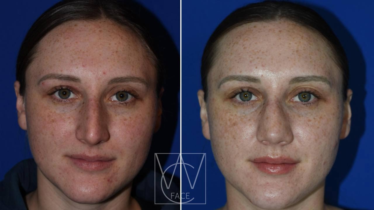 A result from Joseph Shvidler, MD