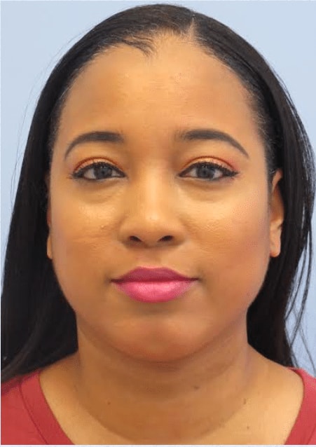 A result from The Brandow Clinic