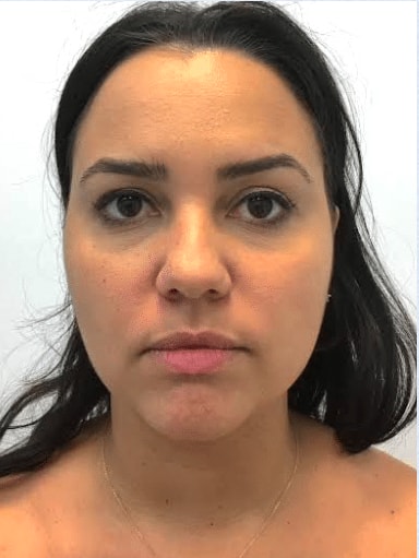 A result from The Brandow Clinic