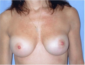 A result from The Brandow Clinic
