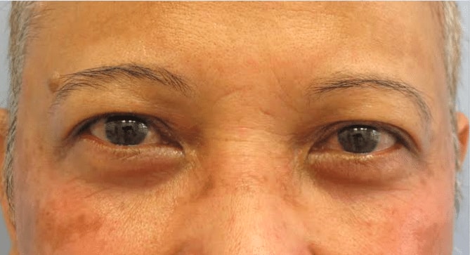 A result from The Brandow Clinic