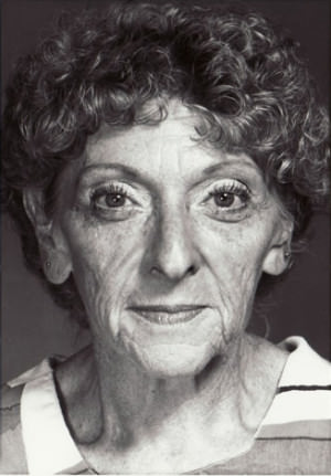 Facelift before photo