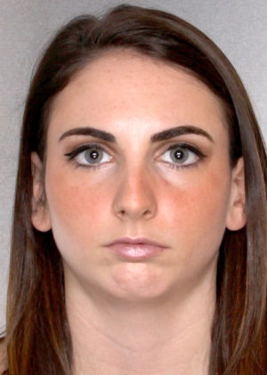 Rhinoplasty before photo