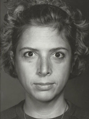 Rhinoplasty result at New York Plastic Surgery