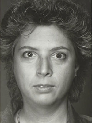 Rhinoplasty before photo