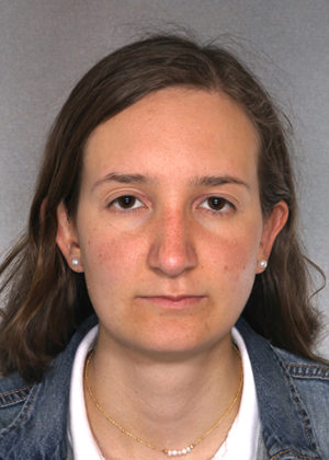 Rhinoplasty result at New York Plastic Surgery