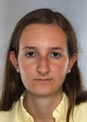Rhinoplasty before photo